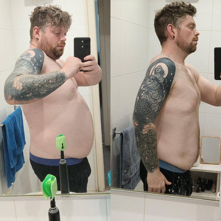 Client before and after side view
