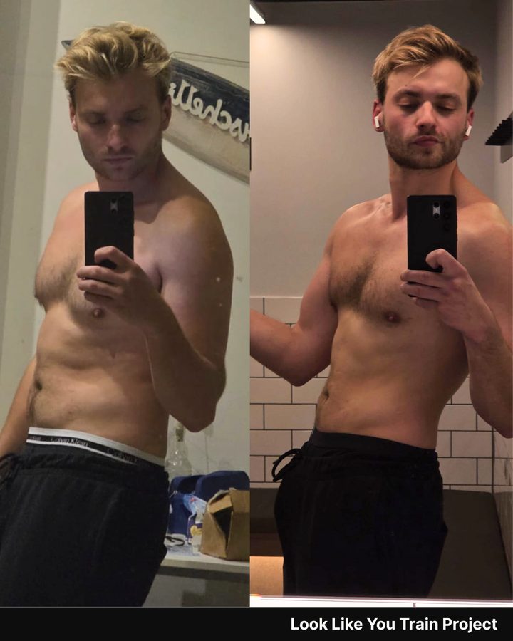 Client before and after side view